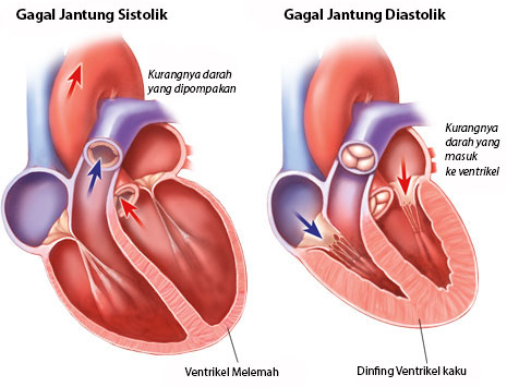 Mengenal Penyakit Jantung